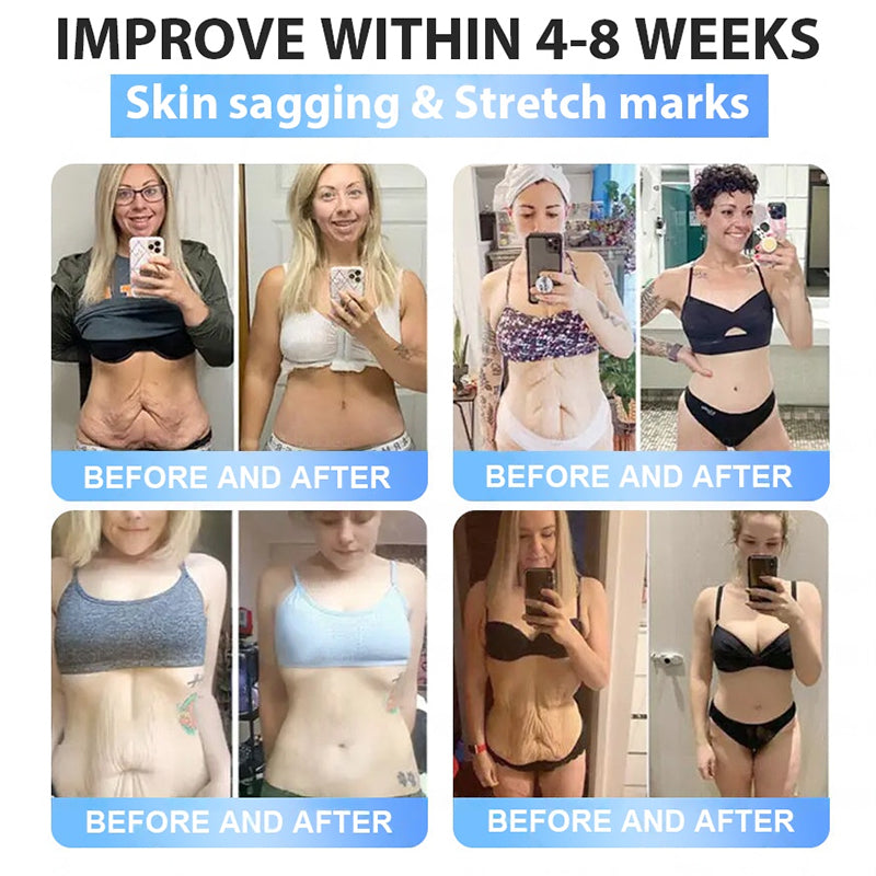 FDA Official Store | Rpaweightloss GLP-1 Slim & Firm Nano Microneedle Patch with Collagen, Turmeric & Matrixyl 3000丨Obesity, Cardiovascular Disease, Diabetes, Sleep Apnea, Joint Problems and More