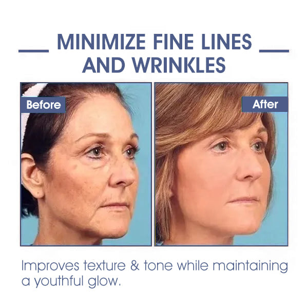 𝐋𝐚𝐬𝐭 𝐃𝐚𝐲 𝐃𝐢𝐬𝐜𝐨𝐮𝐧𝐭: 85% 𝐎𝐅𝐅🔥𝐅𝐮𝐛𝐬𝐭𝐚® 𝐀𝐝𝐯𝐚𝐧𝐜𝐞𝐝 𝐅𝐢𝐫𝐦𝐢𝐧𝐠 & 𝐖𝐫𝐢𝐧𝐤𝐥𝐞-𝐑𝐞𝐝𝐮𝐜𝐢𝐧𝐠 𝐂𝐫𝐞𝐚𝐦: Restore Skin Elasticity👩⚕️👩⚕️