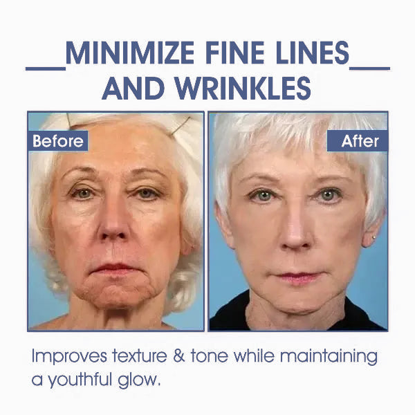 𝐋𝐚𝐬𝐭 𝐃𝐚𝐲 𝐃𝐢𝐬𝐜𝐨𝐮𝐧𝐭: 85% 𝐎𝐅𝐅🔥𝐅𝐮𝐛𝐬𝐭𝐚® 𝐀𝐝𝐯𝐚𝐧𝐜𝐞𝐝 𝐅𝐢𝐫𝐦𝐢𝐧𝐠 & 𝐖𝐫𝐢𝐧𝐤𝐥𝐞-𝐑𝐞𝐝𝐮𝐜𝐢𝐧𝐠 𝐂𝐫𝐞𝐚𝐦: Restore Skin Elasticity👩⚕️👩⚕️
