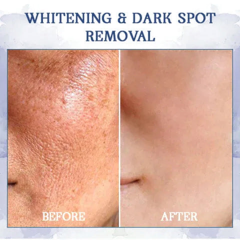 𝐋𝐚𝐬𝐭 𝐃𝐚𝐲 𝐃𝐢𝐬𝐜𝐨𝐮𝐧𝐭: 85% 𝐎𝐅𝐅🔥𝐅𝐮𝐛𝐬𝐭𝐚® 𝐀𝐝𝐯𝐚𝐧𝐜𝐞𝐝 𝐅𝐢𝐫𝐦𝐢𝐧𝐠 & 𝐖𝐫𝐢𝐧𝐤𝐥𝐞-𝐑𝐞𝐝𝐮𝐜𝐢𝐧𝐠 𝐂𝐫𝐞𝐚𝐦: Restore Skin Elasticity👩⚕️👩⚕️