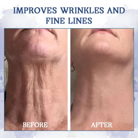 𝐋𝐚𝐬𝐭 𝐃𝐚𝐲 𝐃𝐢𝐬𝐜𝐨𝐮𝐧𝐭: 85% 𝐎𝐅𝐅🔥𝐅𝐮𝐛𝐬𝐭𝐚® 𝐀𝐝𝐯𝐚𝐧𝐜𝐞𝐝 𝐅𝐢𝐫𝐦𝐢𝐧𝐠 & 𝐖𝐫𝐢𝐧𝐤𝐥𝐞-𝐑𝐞𝐝𝐮𝐜𝐢𝐧𝐠 𝐂𝐫𝐞𝐚𝐦: Restore Skin Elasticity👩⚕️👩⚕️