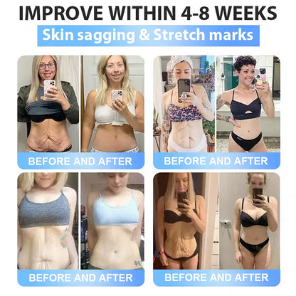 FDA Official Store | Rpaweightloss GLP-1 Slim & Firm Nano Microneedle Patch with Collagen, Turmeric & Matrixyl 3000丨Obesity, Cardiovascular Disease, Diabetes, Sleep Apnea, Joint Problems and More