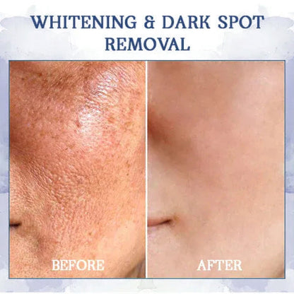 𝐋𝐚𝐬𝐭 𝐃𝐚𝐲 𝐃𝐢𝐬𝐜𝐨𝐮𝐧𝐭: 85% 𝐎𝐅𝐅🔥𝐅𝐮𝐛𝐬𝐭𝐚® 𝐀𝐝𝐯𝐚𝐧𝐜𝐞𝐝 𝐅𝐢𝐫𝐦𝐢𝐧𝐠 & 𝐖𝐫𝐢𝐧𝐤𝐥𝐞-𝐑𝐞𝐝𝐮𝐜𝐢𝐧𝐠 𝐂𝐫𝐞𝐚𝐦: Restore Skin Elasticity👩‍⚕️👩‍⚕️